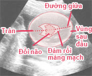 cơ thể thai nhi từ tuần 24 đến 27